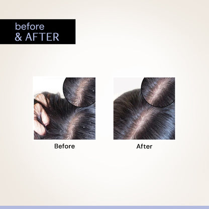 Deconstruct Anti Dandruff Serum, Exfoliates & Soothes Scalp