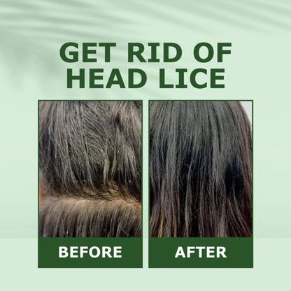 Nuerma Science Tea Tree Hair Oil for Anti Dandruff, Hair Fall Control & Itchiness Control