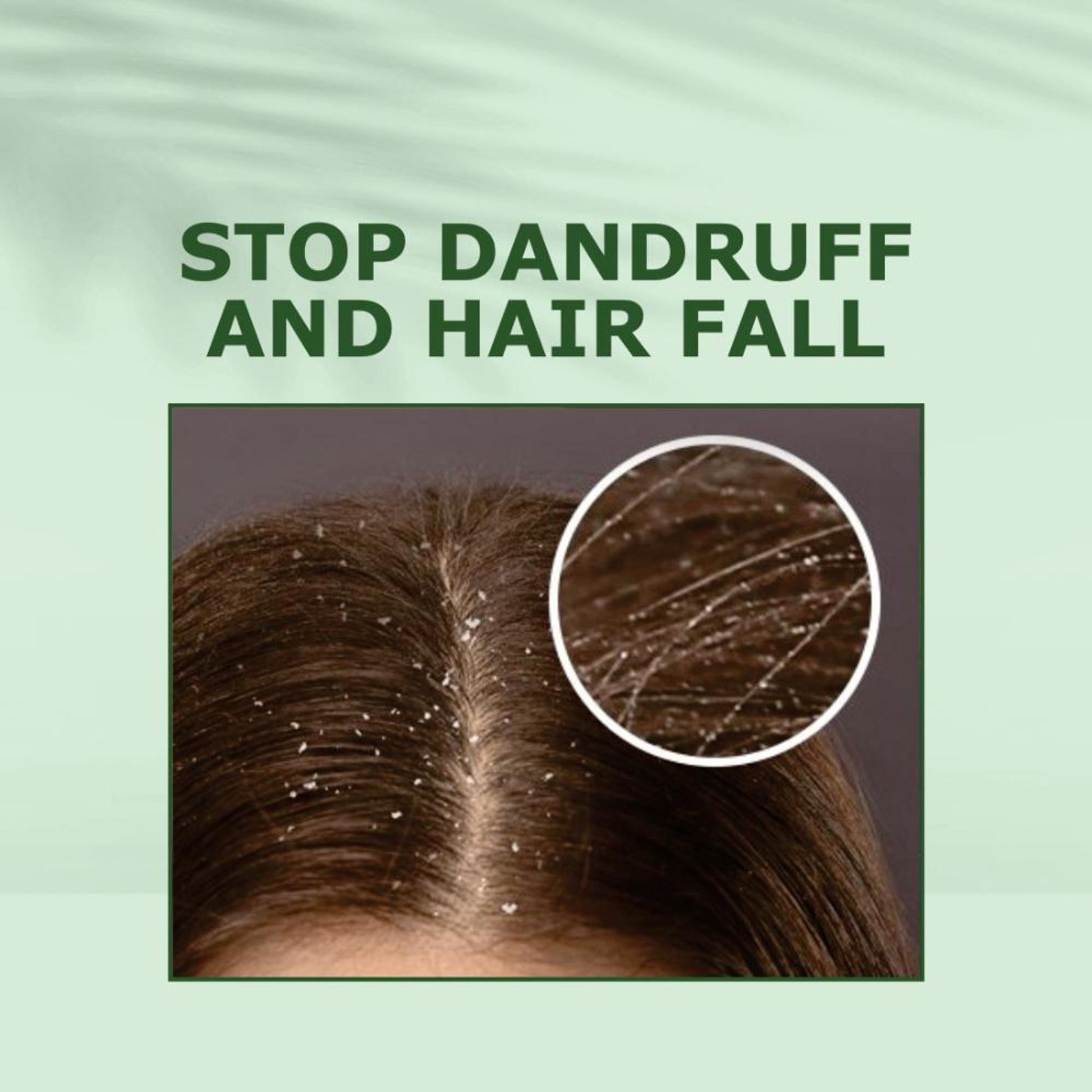 Nuerma Science Tea Tree Hair Oil for Anti Dandruff, Hair Fall Control & Itchiness Control