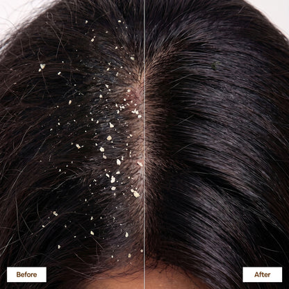 Eleganz Professional Anti-Dandruff Conditioner with Rosemary & Biotin, Moisturizes & Reduces Frizz