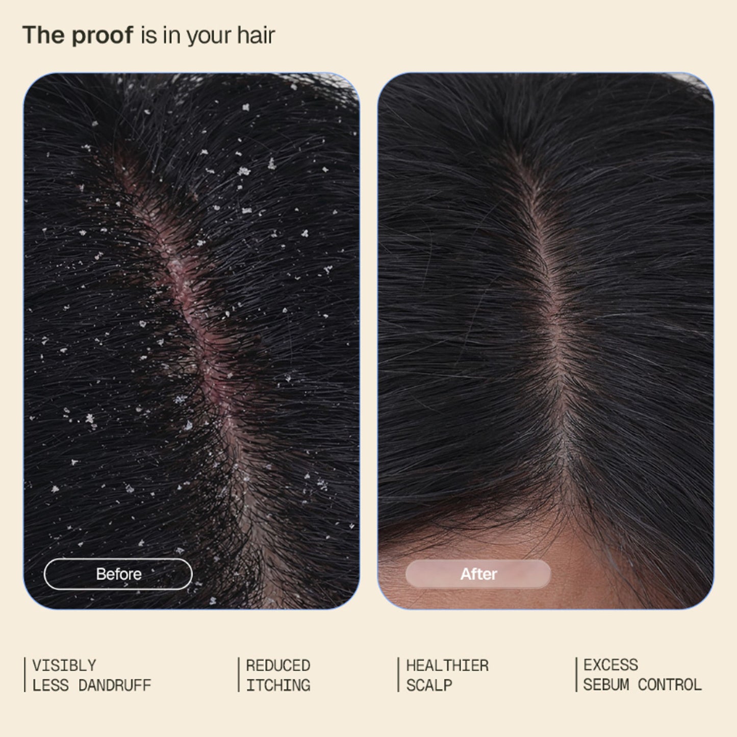 Arata Anti-Dandruff Hair Tonic