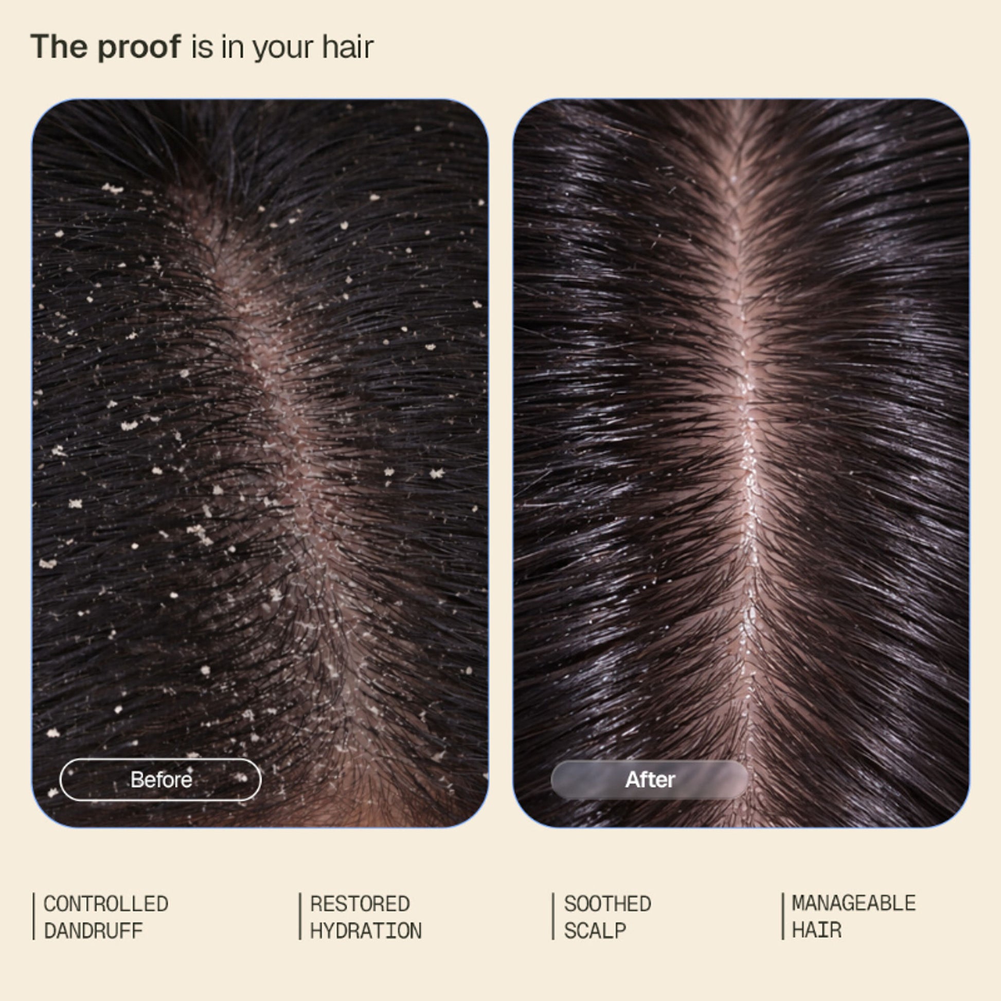 Arata Anti-Dandruff Conditioner, Soothes, Hydrates & Controls Flakes