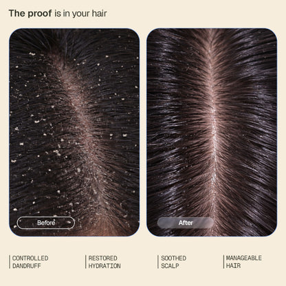 Arata Anti-Dandruff Conditioner, Soothes, Hydrates & Controls Flakes