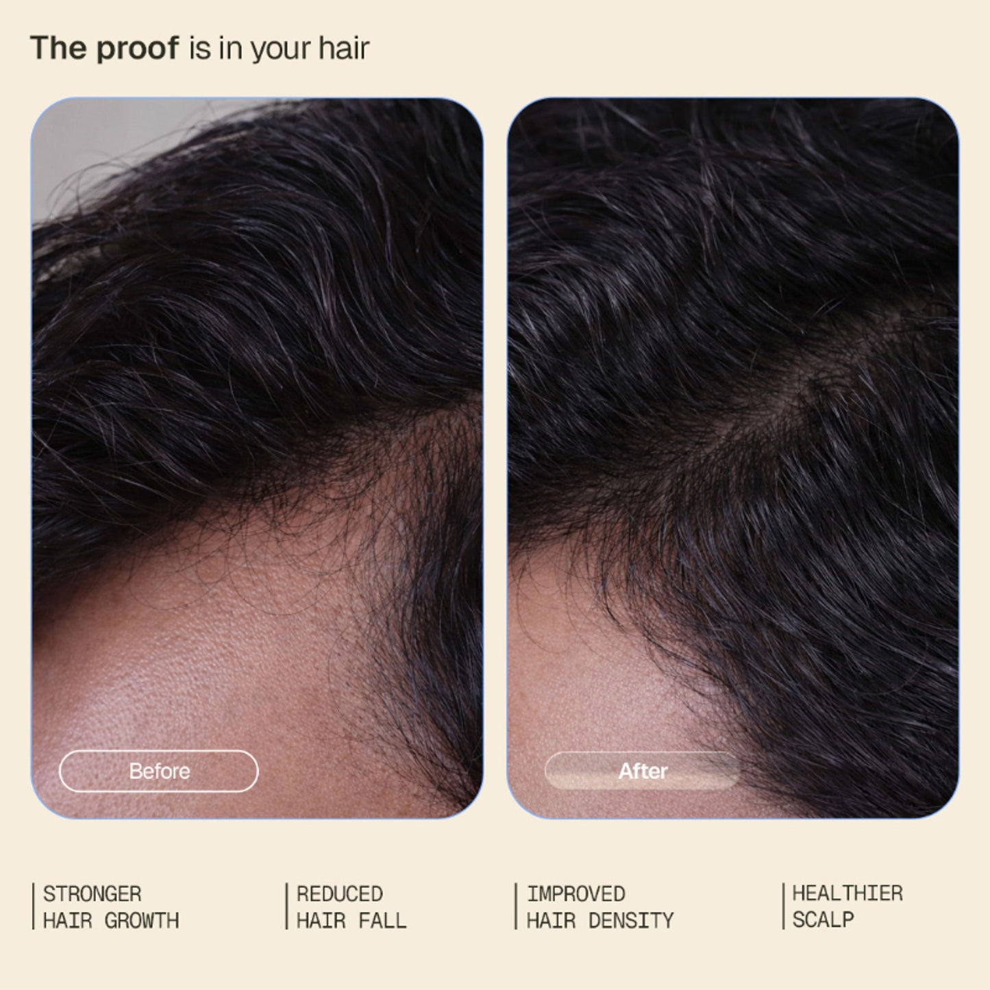Arata Hair Growth Serum With 3% Redensyl, 3% Procapil, 5% Kopexil, No Minoxidil, Supports Hair Growth
