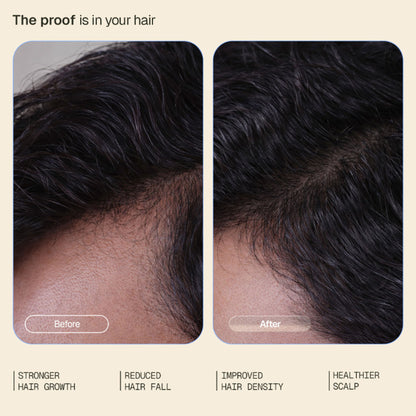 Arata Hair Growth Serum With 3% Redensyl, 3% Procapil, 5% Kopexil, No Minoxidil, Supports Hair Growth