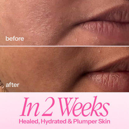 d'you In My Defence Barrier-Building Moisturiser With 20x More Ceramides (Lightweight & Non-Greasy)