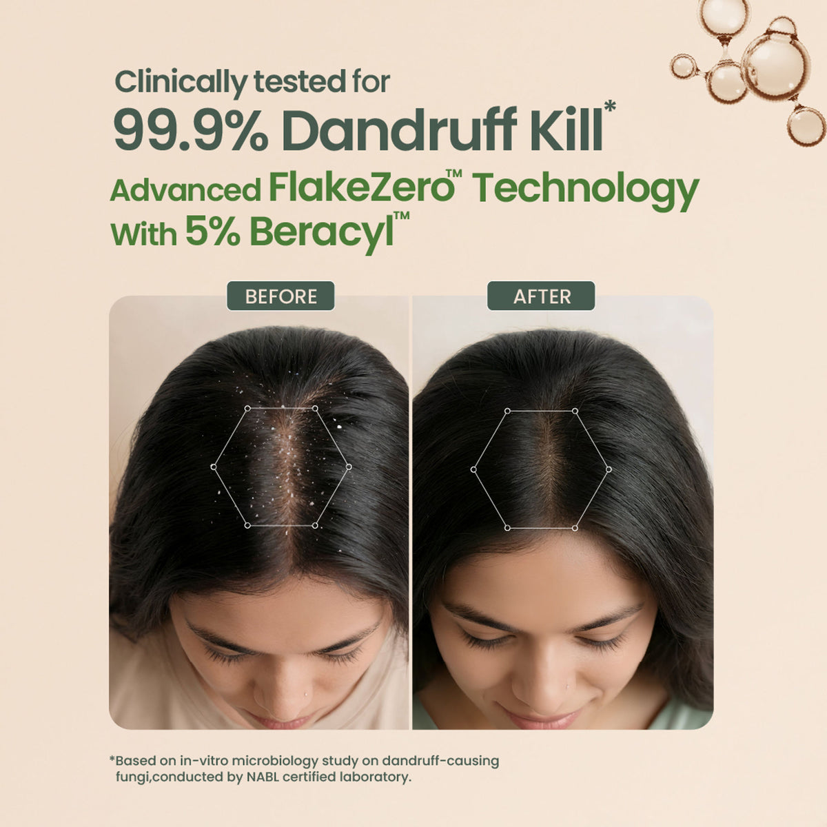 Nat Habit Anti-Dandruff Neem Beracyl Navdha Shampoo