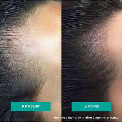 Arata Intensive Hair Growth Serum - Indyancart