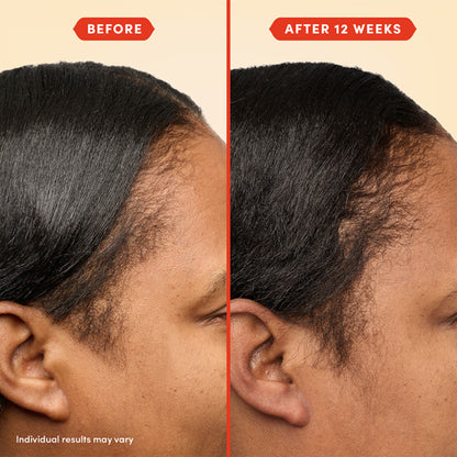 Fable & Mane Holiroots Treatment Oil With Ashwagandha & Amla For Growth, Hydration & Healthier Hair