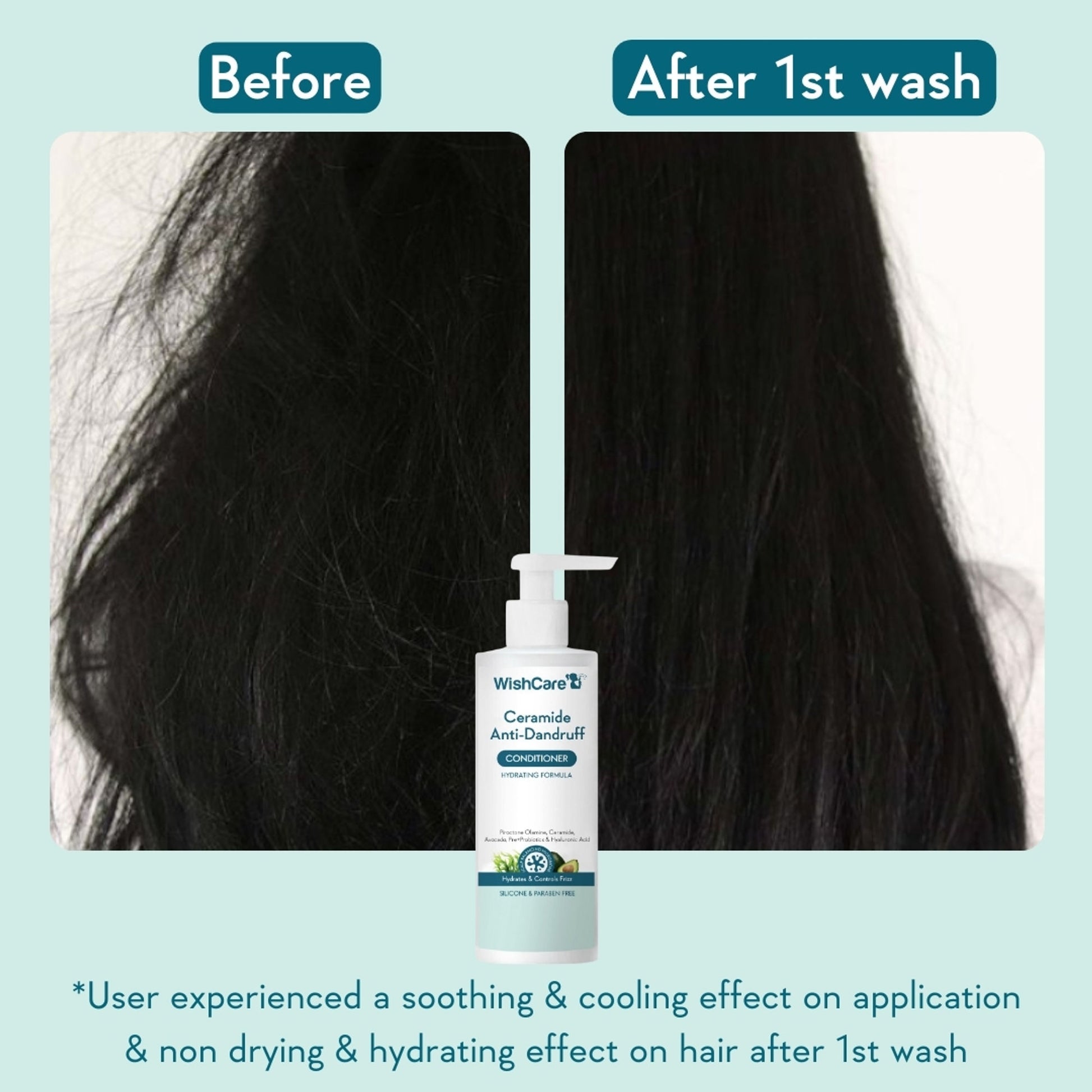 WishCare Ceramide Anti Dandruff Conditioner for Dry & Frizzy Hair - Controls Dandruff & Adds Shine