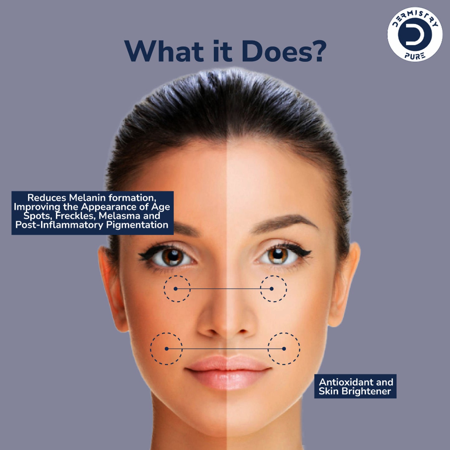 DERMISTRY 2% Kojic Acid Alpha Arbutin Face Serum Pigmentation Removal Lightening Whitening Fairness
