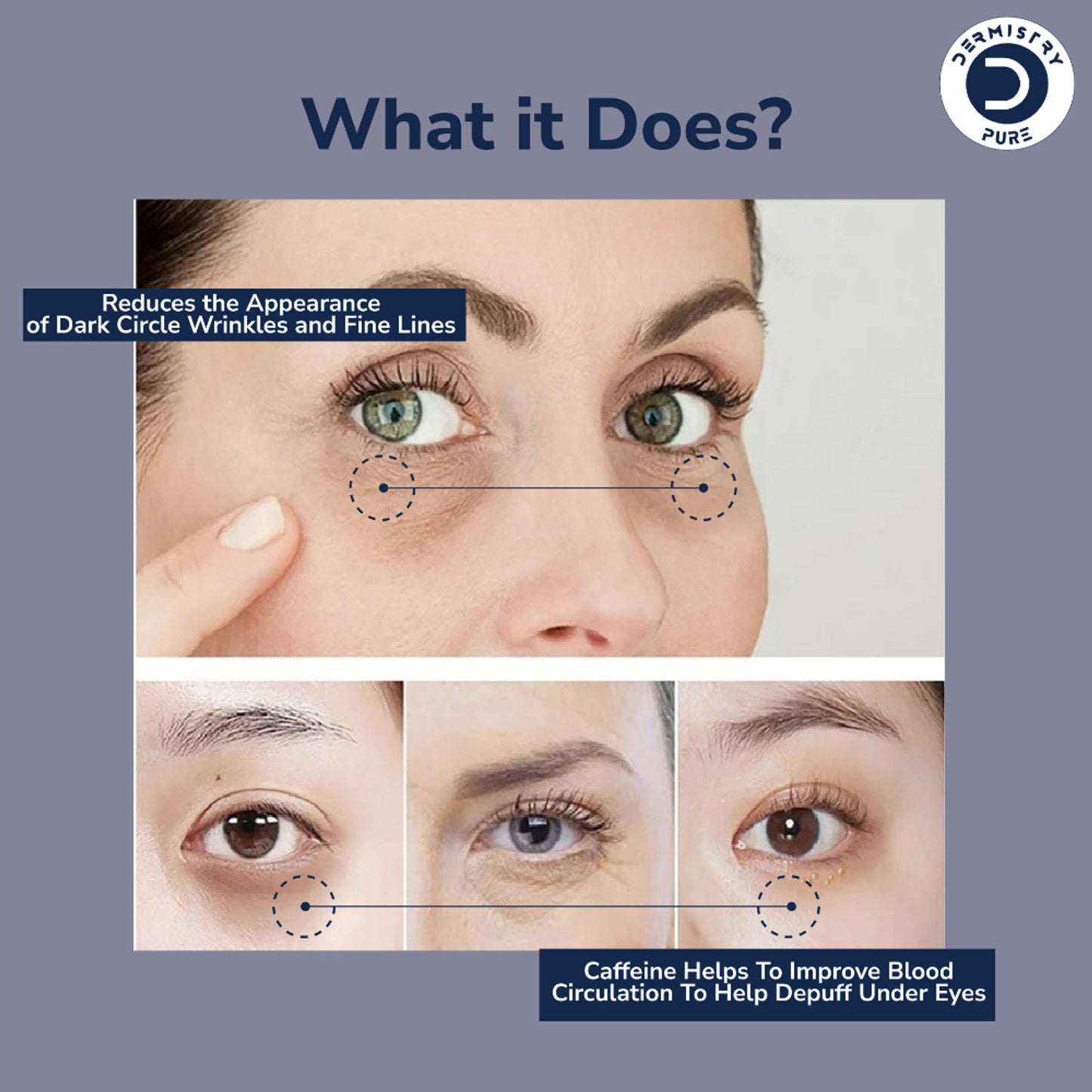 DERMISTRY 0.6% Retinol Caffeine Under Eye Cream Serum for Dark Circles Puffiness Wrinkles Puffy Eyes
