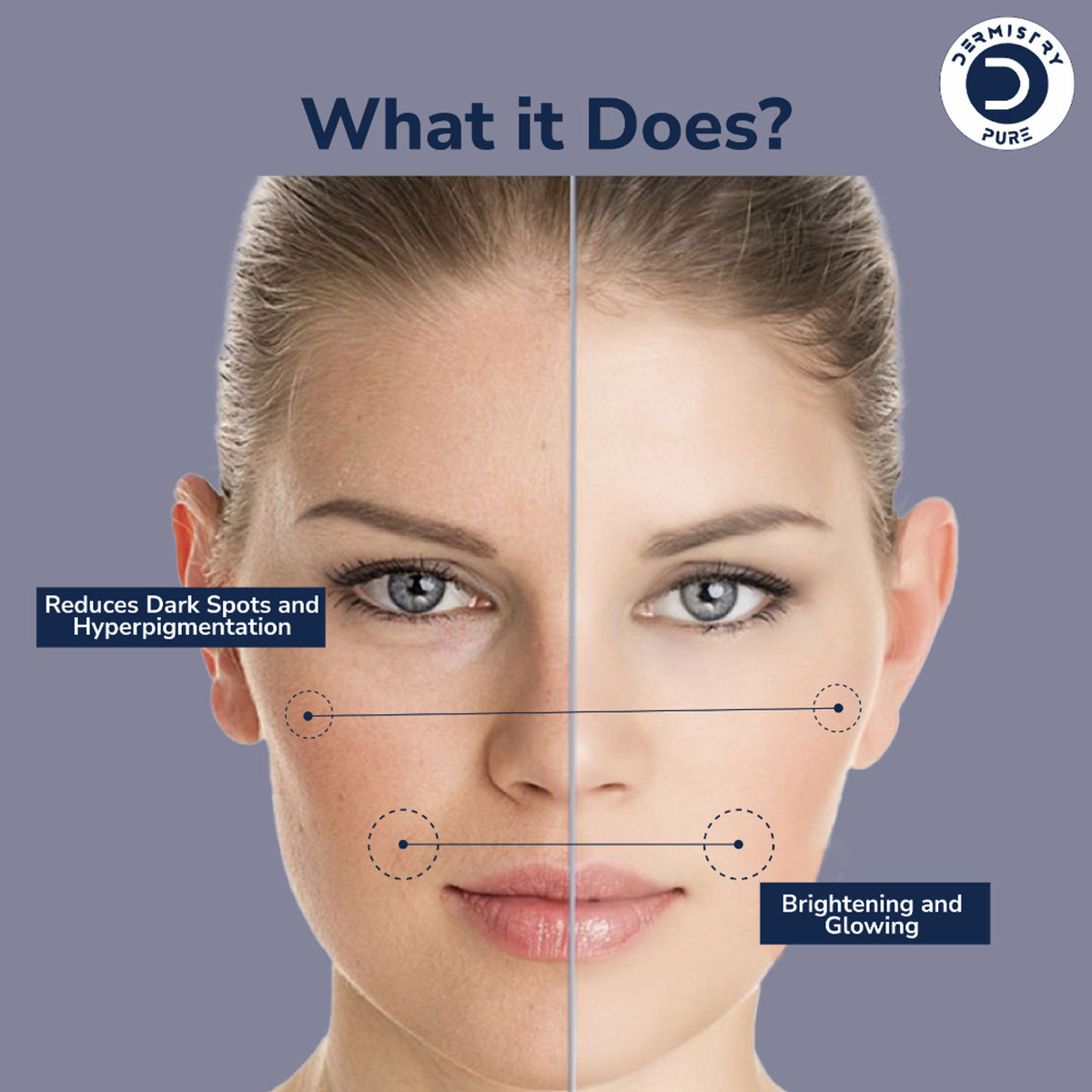 DERMISTRY 16% Vitamin C face serum in a clear bottle, showcasing brightening formula for dark spots and dull skin.