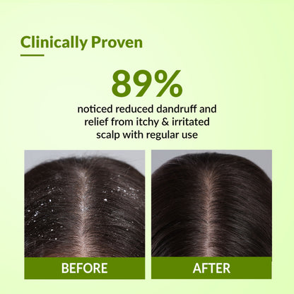 Fixderma Kairfoll Anti Dandruff Shampoo for Oily & Sensitive Prone Scalp, Sulphate Free