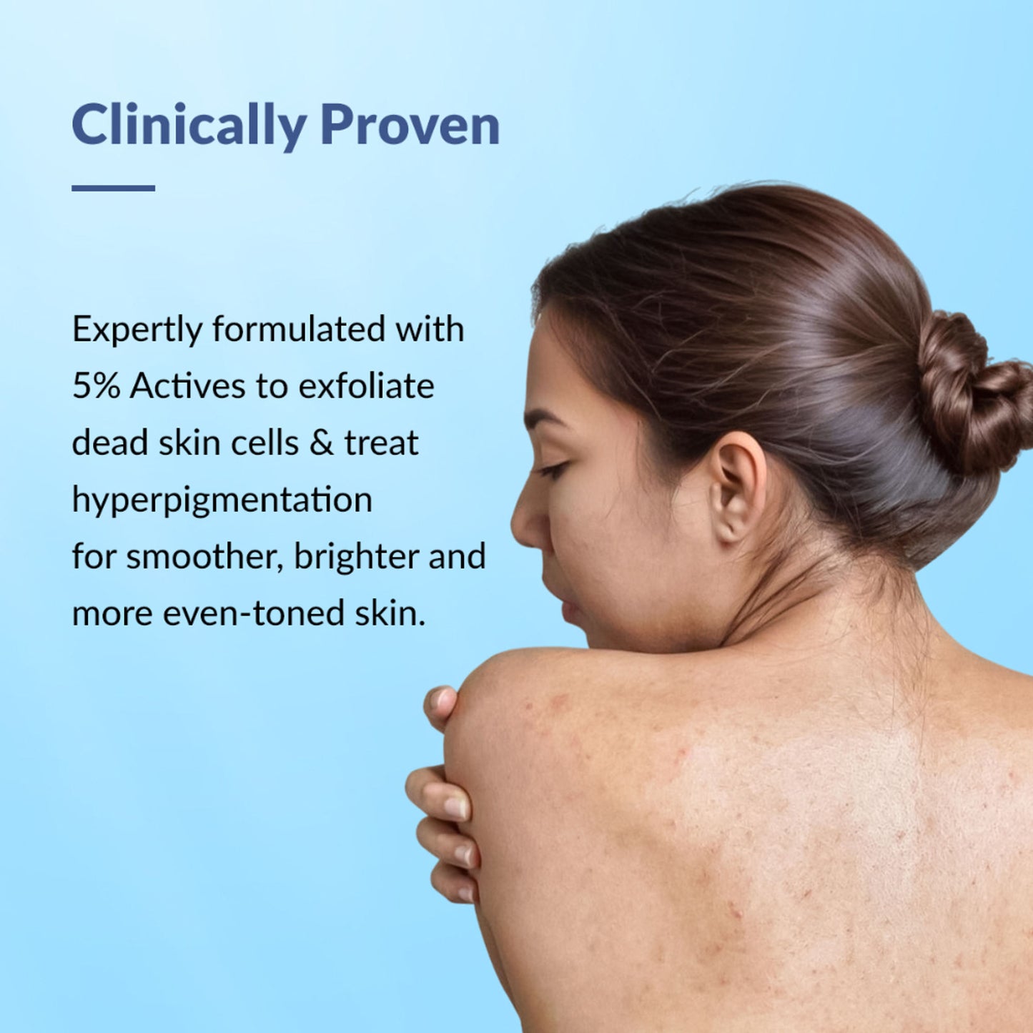Fixderma Nigrifix Exfoliating Body Wash with 5% Actives,Glycolic acid, Lactic Acid Shower Gel