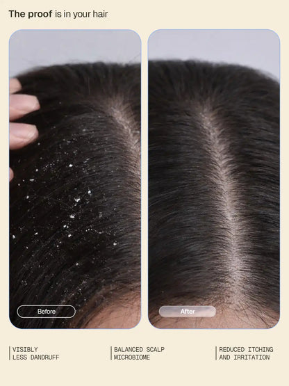Arata Anti-Dandruff Shampoo & Serum Combo