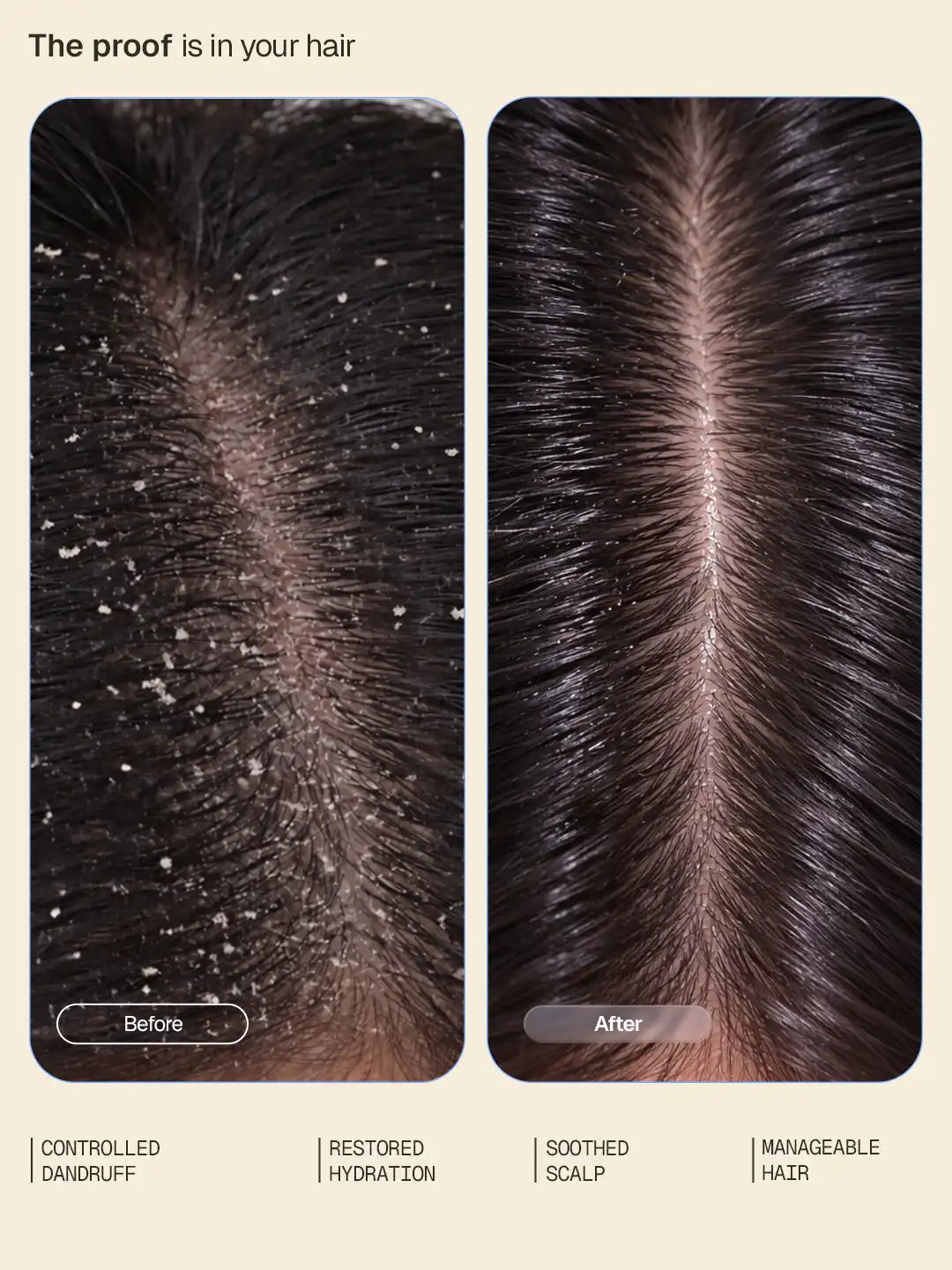 Anti-Dandruff Conditioner - 200 ml