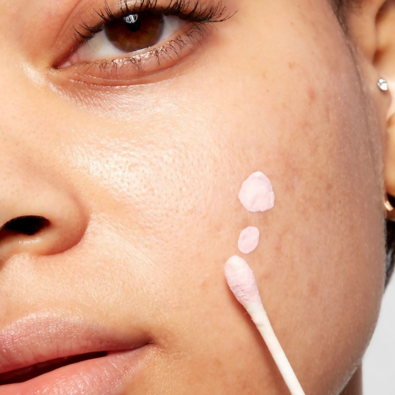 Mario Badescu Acne Spot Corrector drying lotion with salicylic acid in a clear bottle, designed for targeted acne treatment.