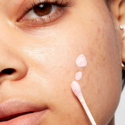 Mario Badescu Acne Spot Corrector drying lotion with salicylic acid in a clear bottle, designed for targeted acne treatment.