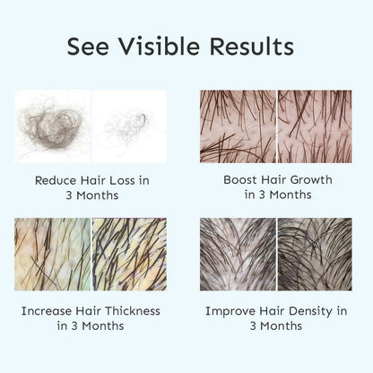 Arata Intensive Hair Growth Serum - Indyancart