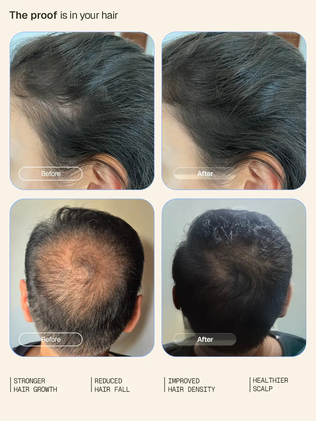 Hair Growth Intensive Serum - 30 ml