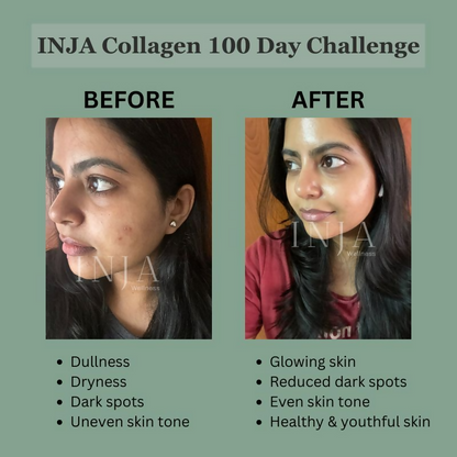 Inja Beauty Collagen skin supplement bottle with orange flavor, featuring biotin, vitamin C, and glutathione for hair, skin, and nails.