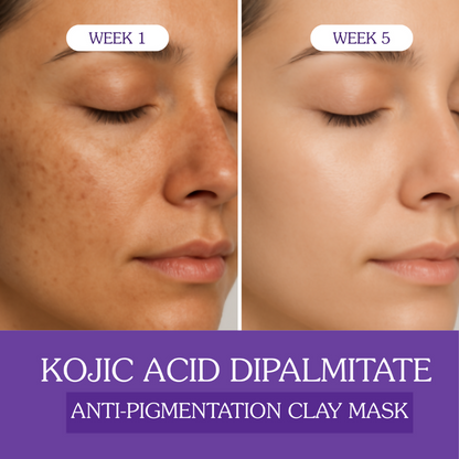 Bake Kojic Acid Anti-Pigmentation Clay Mask