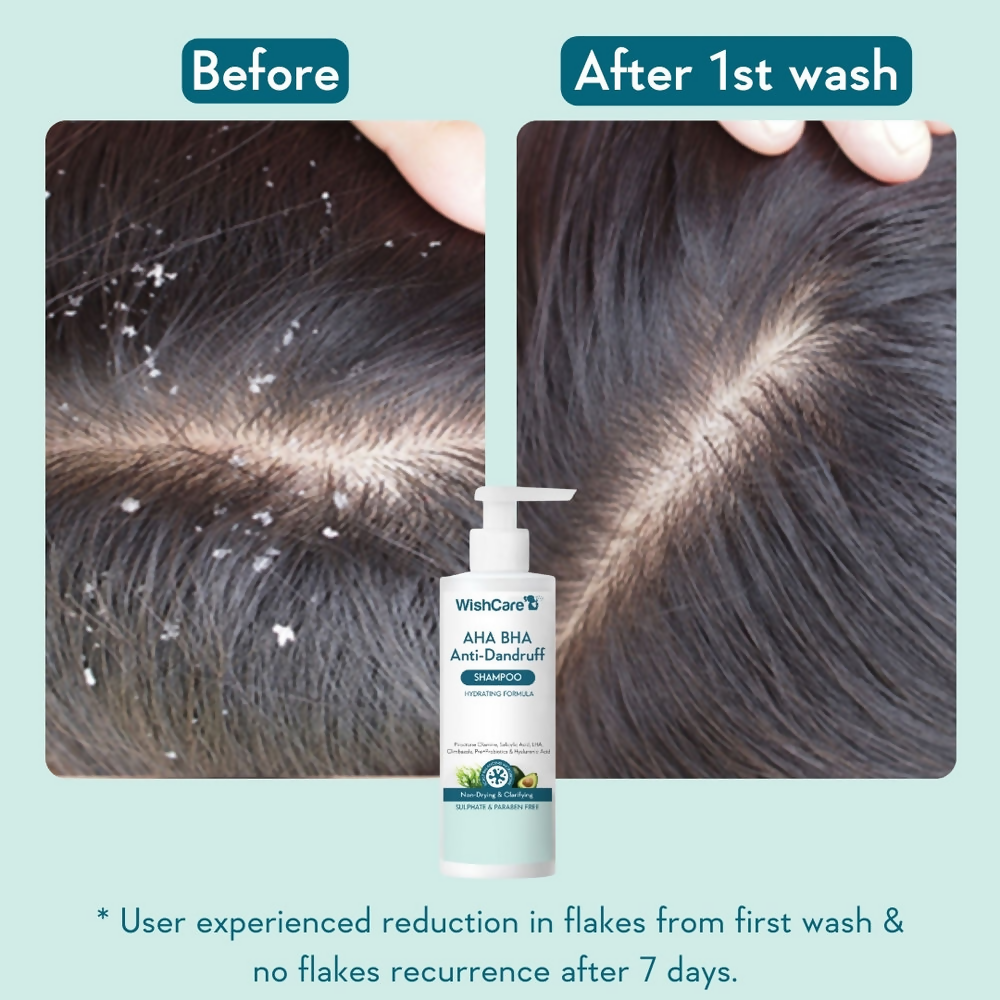 WishCare Aha Bha Anti-Dandruff Shampoo