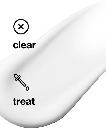 Clinique Anti-Blemish Solutions All-Over Clearing Gel in a clear tube, designed for use as a face gel to target blemishes.