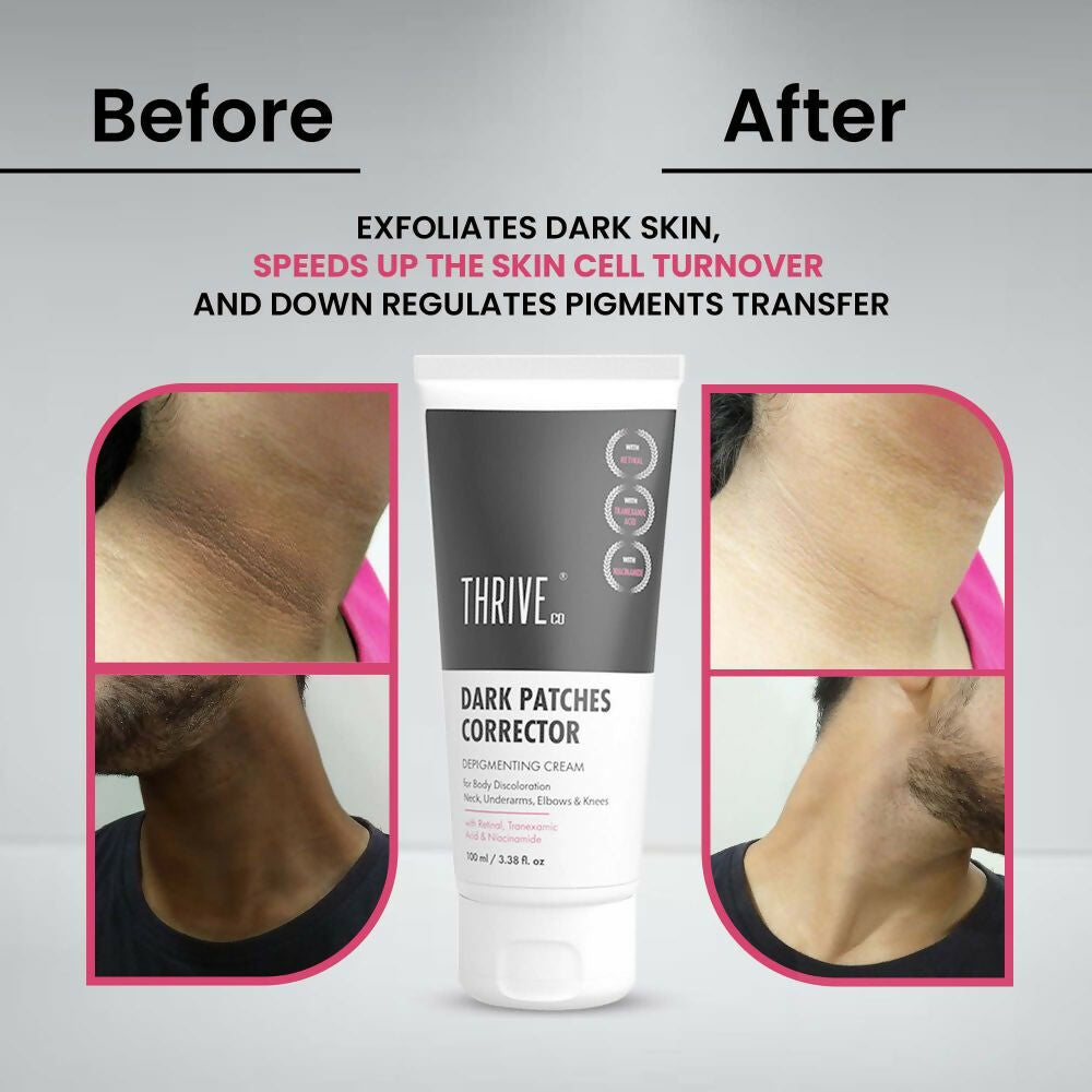 Thriveco Dark Patches Corrector Cream - Indyancart