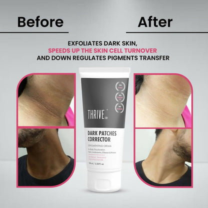 Thriveco Dark Patches Corrector Cream - Indyancart