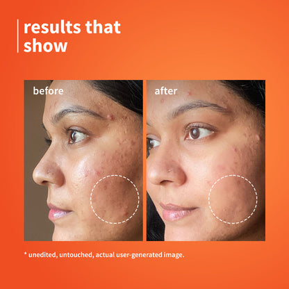 10% Vitamin C & Calendula Barrier Boosting + Glow Serum