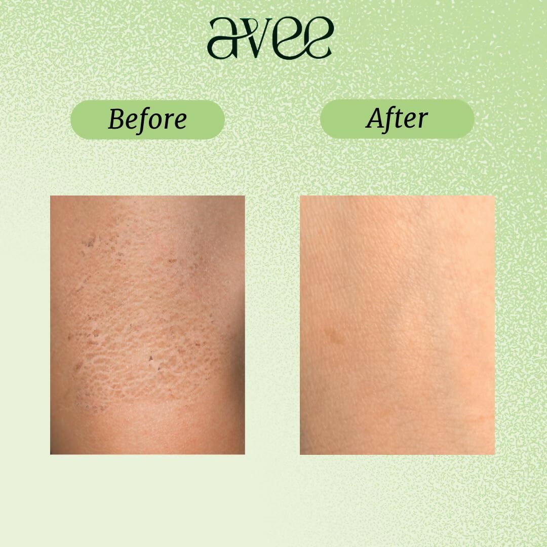 Avee Kids daily baby body lotion with oats, vitamins B5 & E, shea and cocoa butter, providing deep hydration for children aged 5-12.