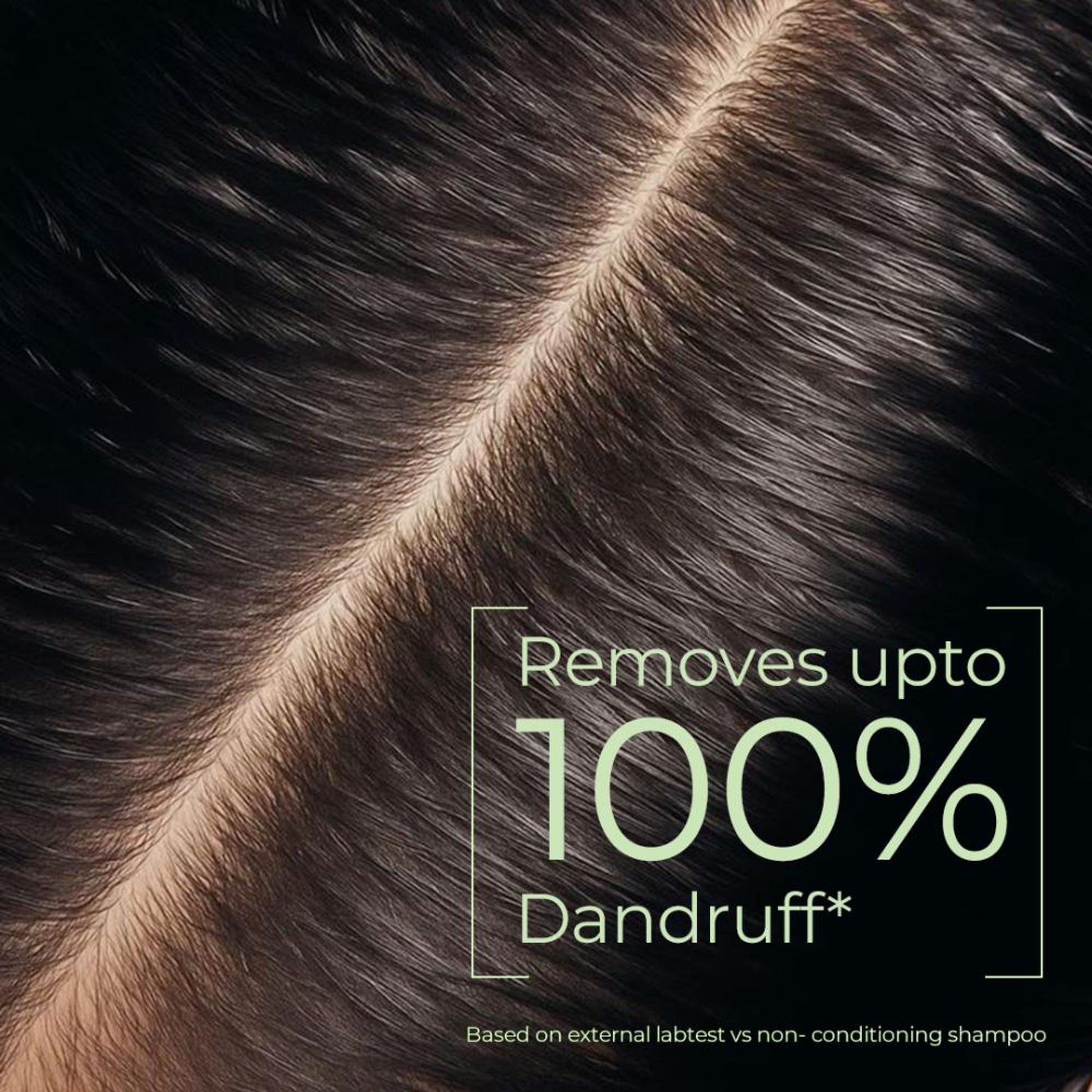 Naturali Dandruff Defence Shampoo with Tea Tree Oil & Cactus Extracts That Prevents Dandruff 370ml