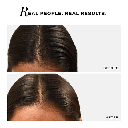 Novology Sebosys Control Scalp Serum, 48 Hours Oil Control, Dermat Tested, Oily, Greasy, Flaky Scalp