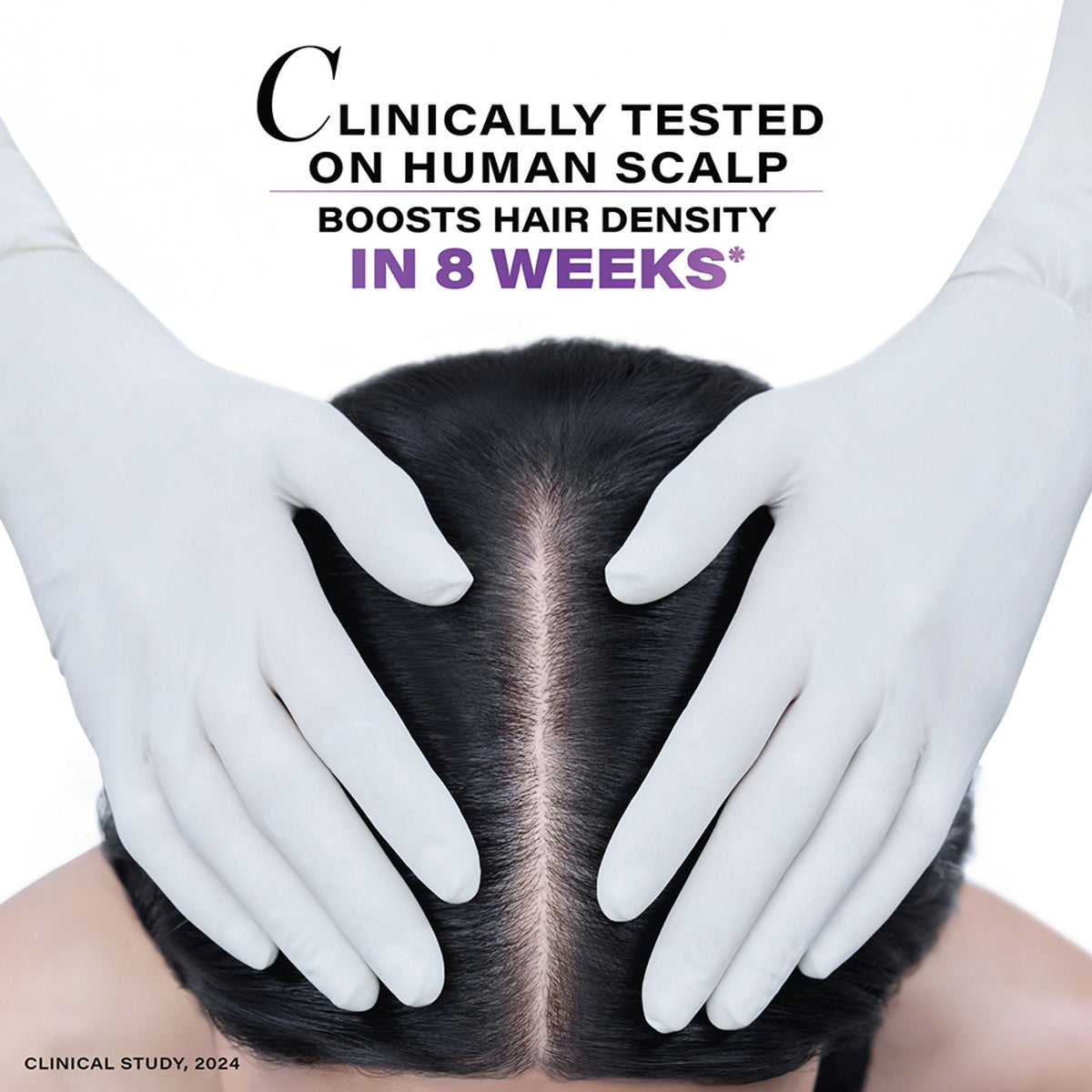 Novology Follicle Revive Scalp Serum, For Hair Growth, Suitable For Sensitive Scalp, Dermat Tested