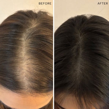 RAS Luxury Oils Root-Ine Hair Elixir With 30 Regenerative Botanicals