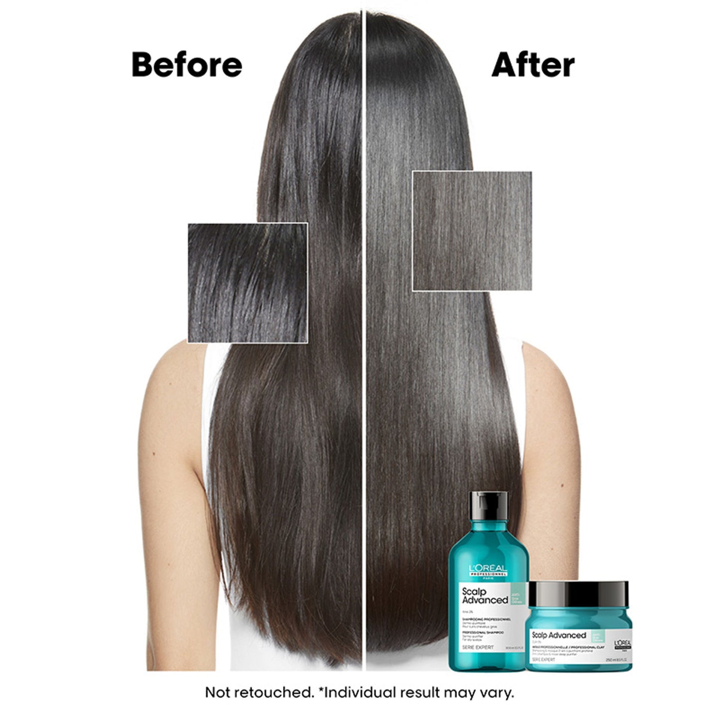 L’Oréal Professionnel Scalp Advanced Anti-Oiliness 2-In-1 Shampoo & Mask for Very Oily Scalp