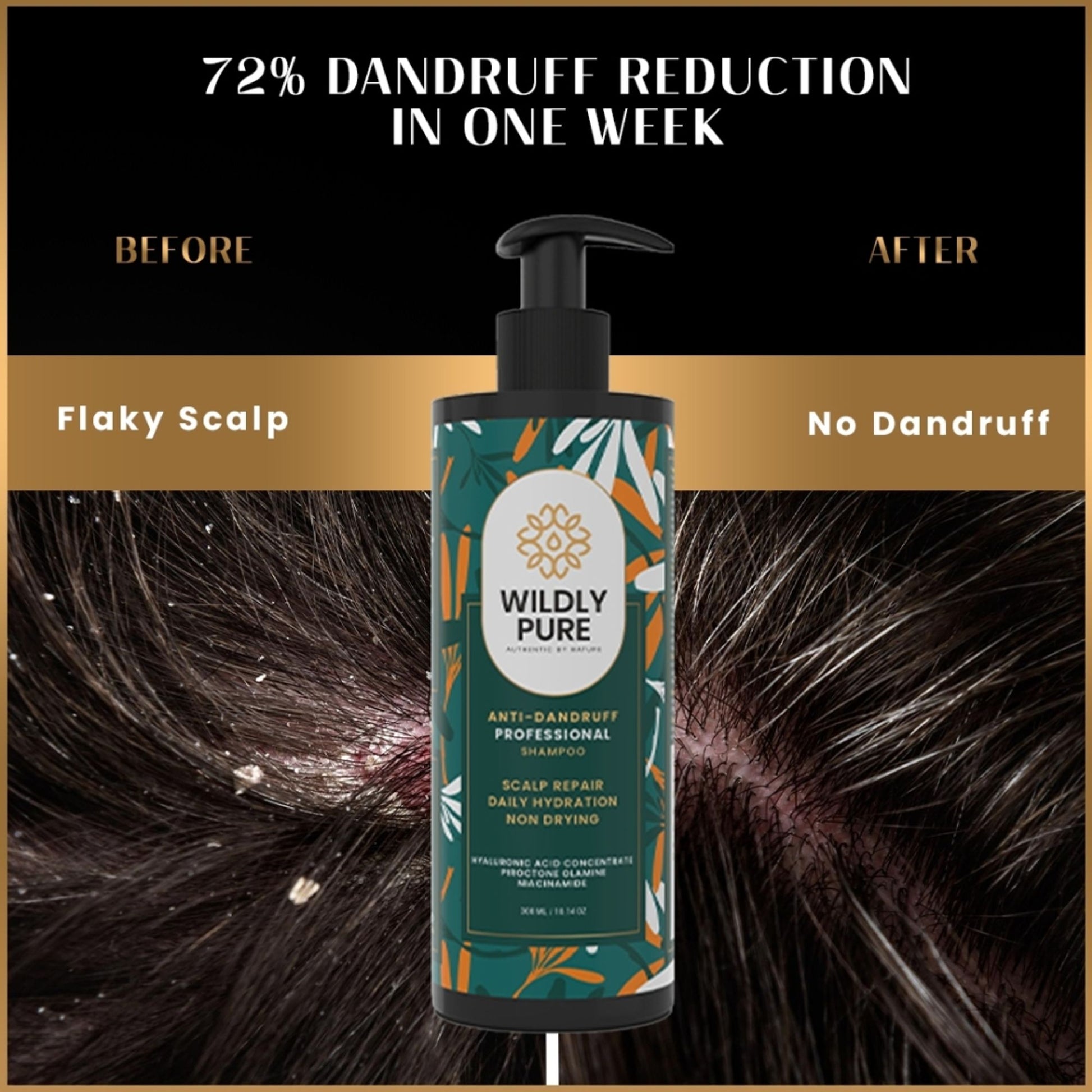 Wildly Pure Anti Dandruff Shampoo for itchy & flaky scalp with Niacinamide & Piroctone Olamine