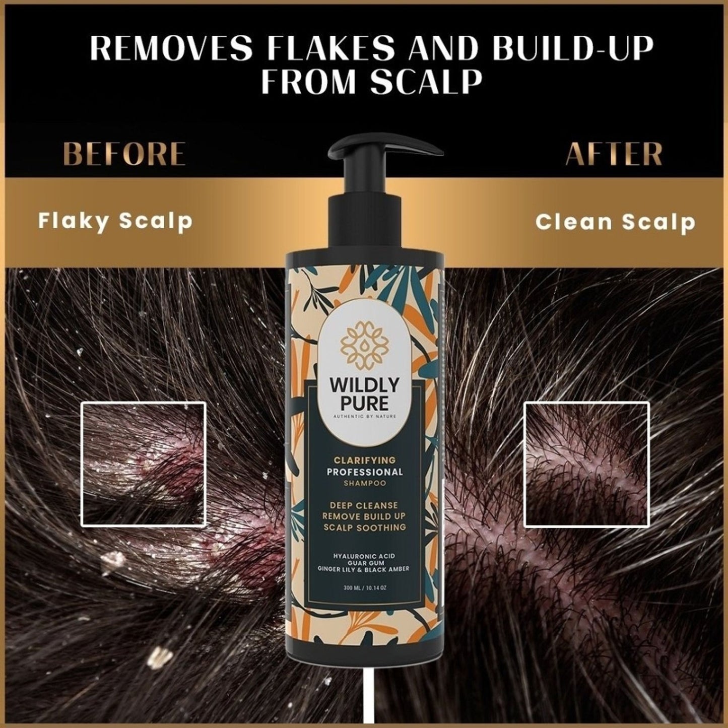Wildly Pure Clarifying Shampoo for Hard Water, Low Porosity Hair, Build Up with Hyaluronic Acid