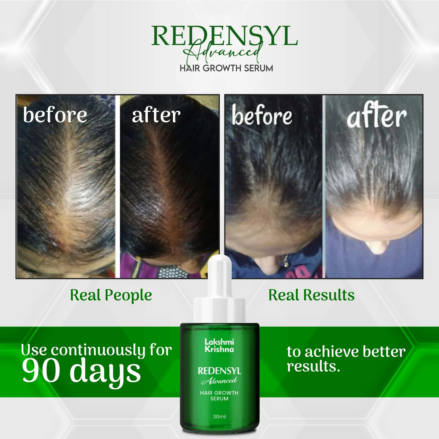 Lakshmi Krishna Naturals Redensyl Advanced Hair Growth Serum bottle, showcasing the hair serum product for thinning hair treatment.