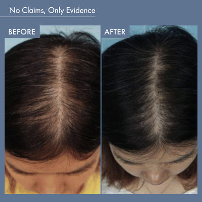 ThriveCo Hair Vitalizing Rosemary Shampoo, Sulphate Free, Hair Fall control, With Hyaplex