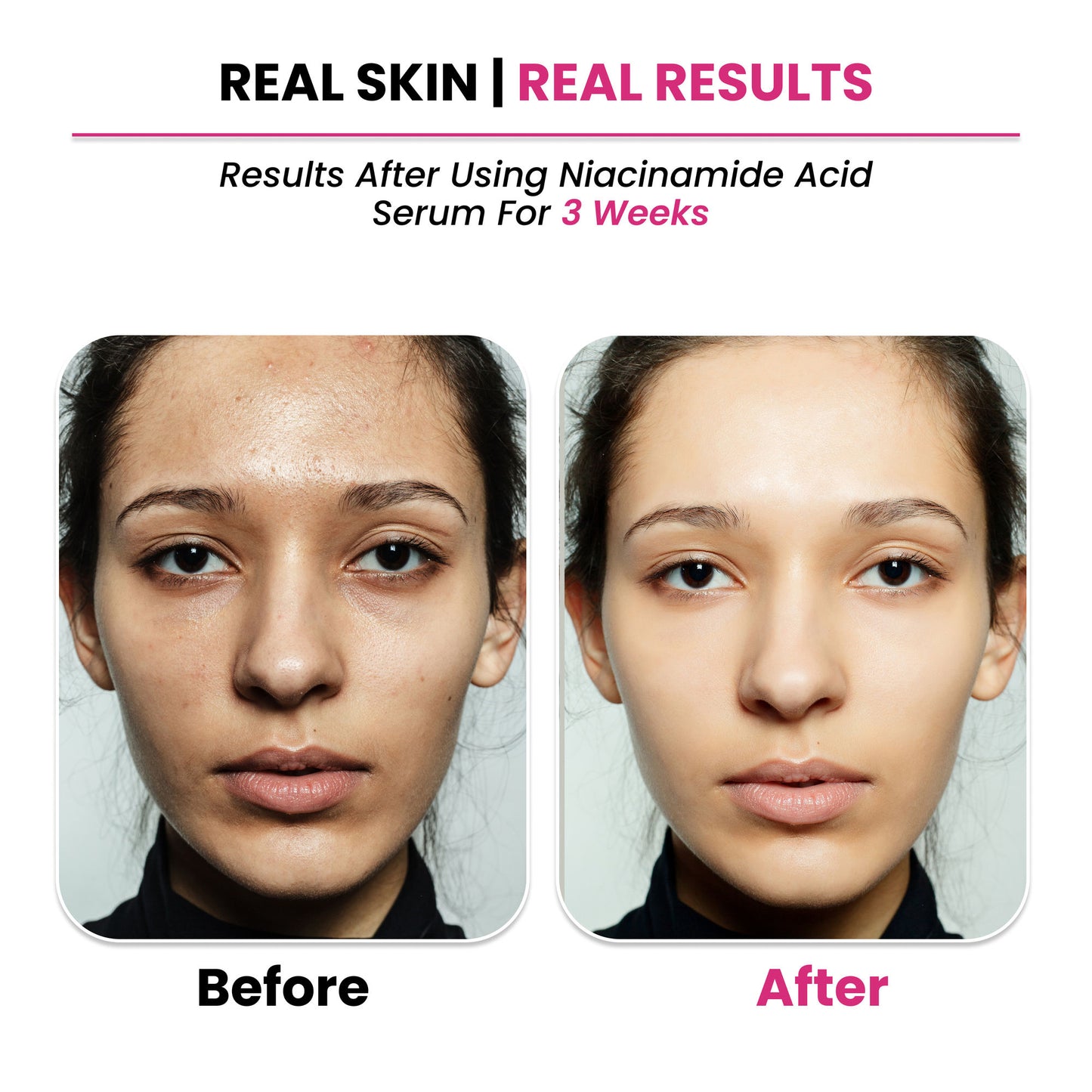 ThriveCo 10% Niacinamide + 1% Zinc PCA Serum