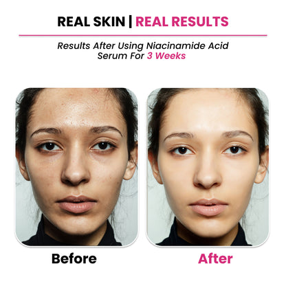 ThriveCo 10% Niacinamide + 1% Zinc PCA Serum