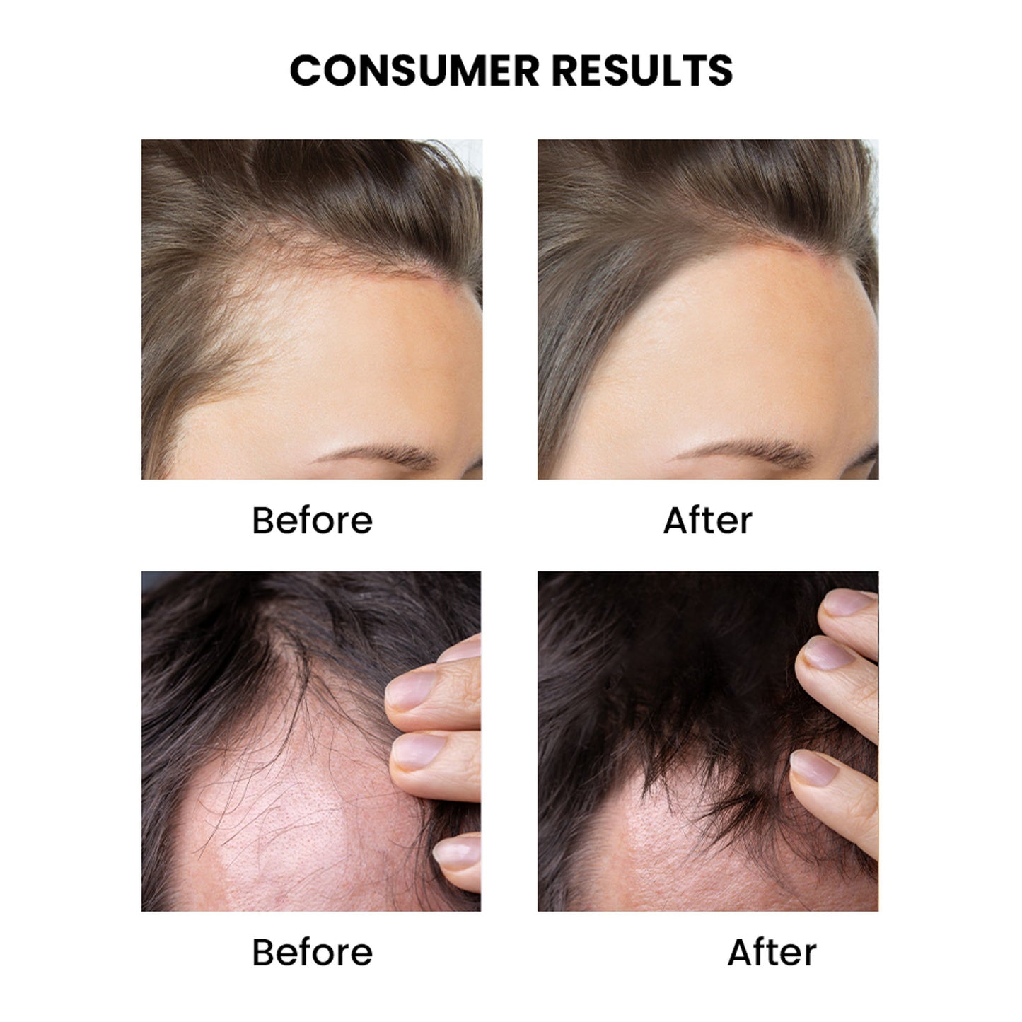 ThriveCo 2-IN-1 Rosemary Mint Scalp & Hair Growth Oil