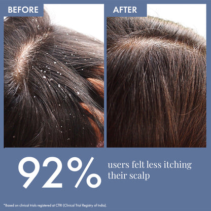 ThriveCo Scalp Clear Shampoo for Dandruff Control