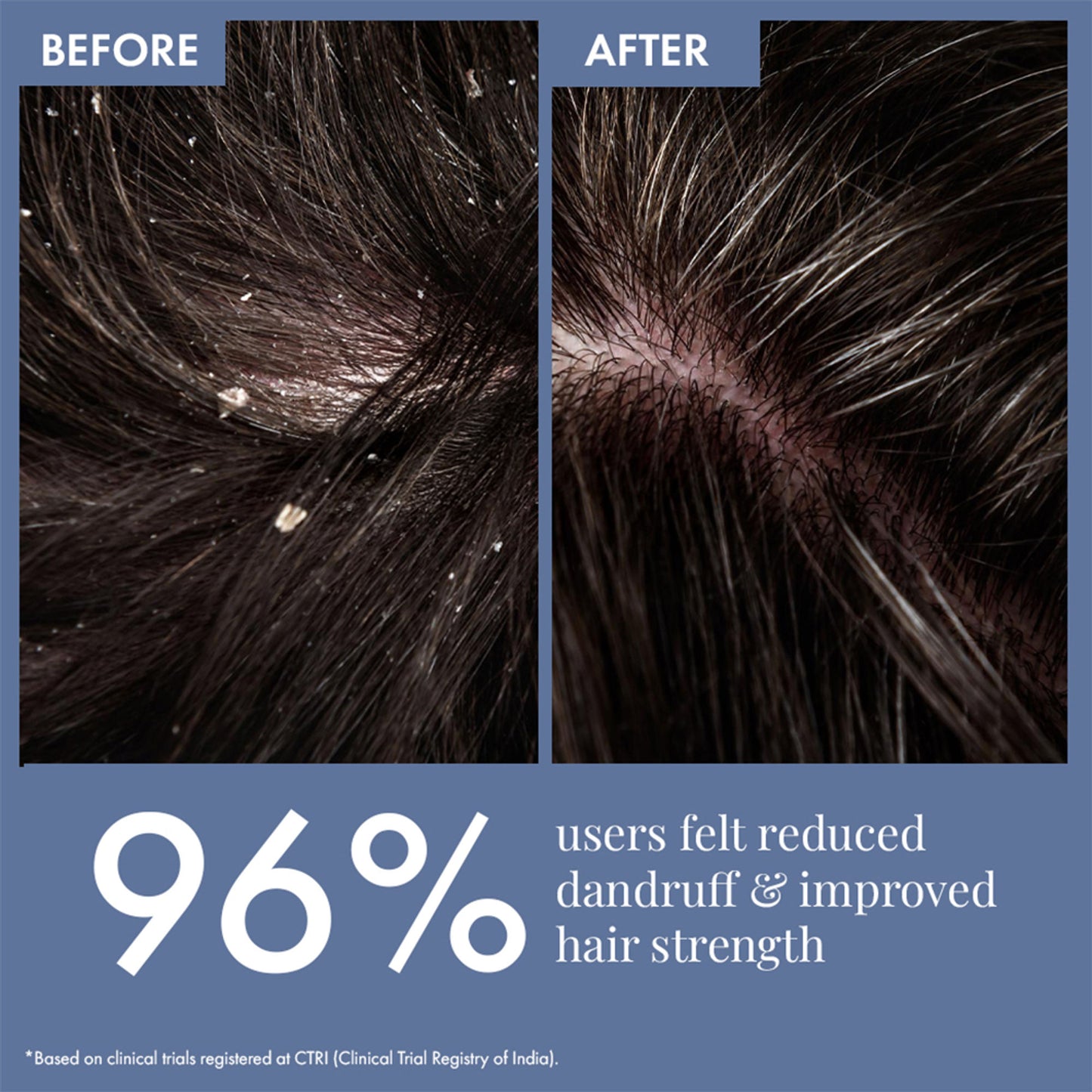ThriveCo Scalp Clear Shampoo for Dandruff Control