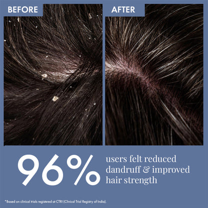 ThriveCo Scalp Clear Shampoo for Dandruff Control