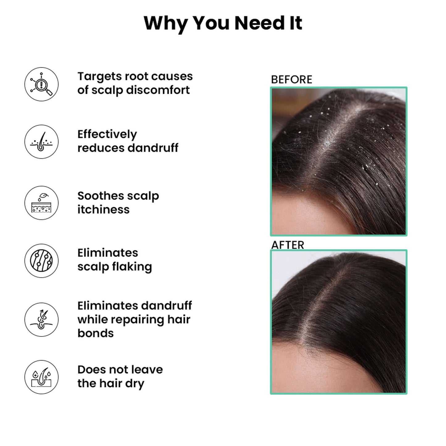 ThriveCo Scalp Clear Shampoo for Dandruff Control