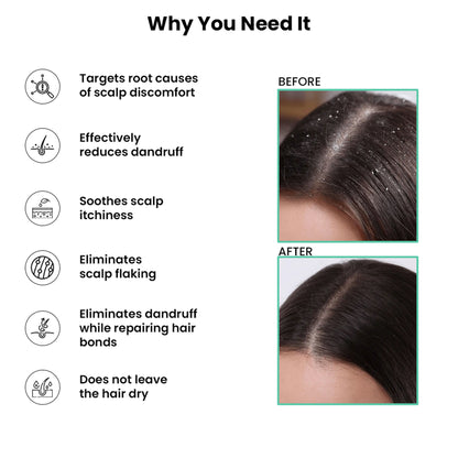 ThriveCo Scalp Clear Shampoo for Dandruff Control